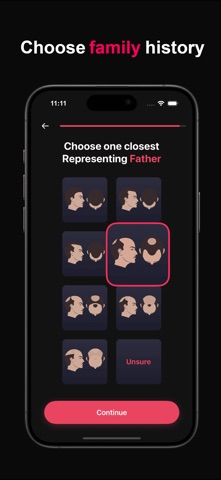 Recede.io – Predict Hairloss screenshot