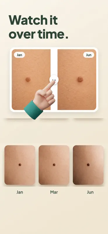 Mole Checker: Skin Scanner screenshot 7 of 10