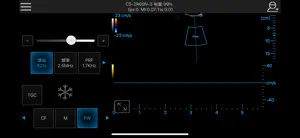 SonicAid screenshot 3