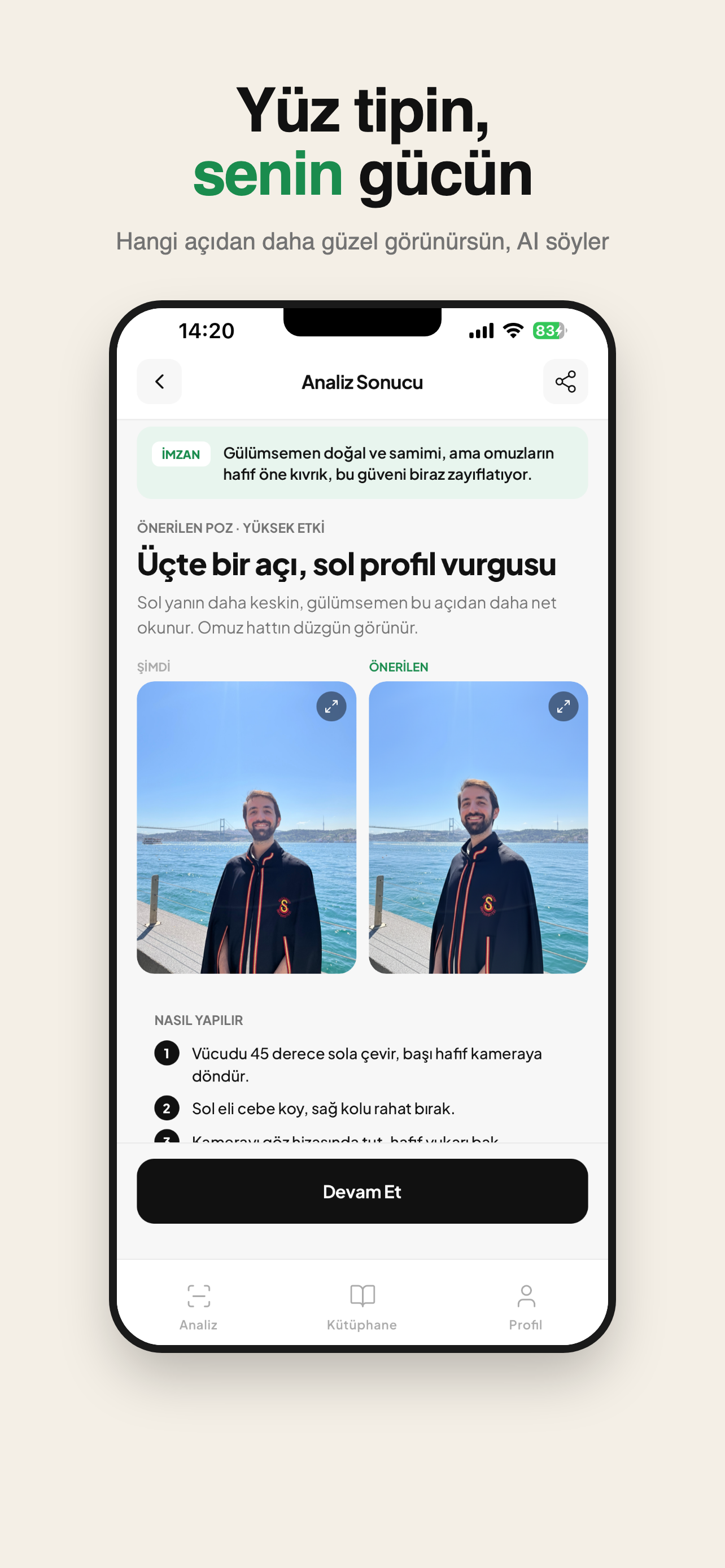 Aura: Poz Analizi