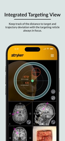 Brain Target Guidance screenshot