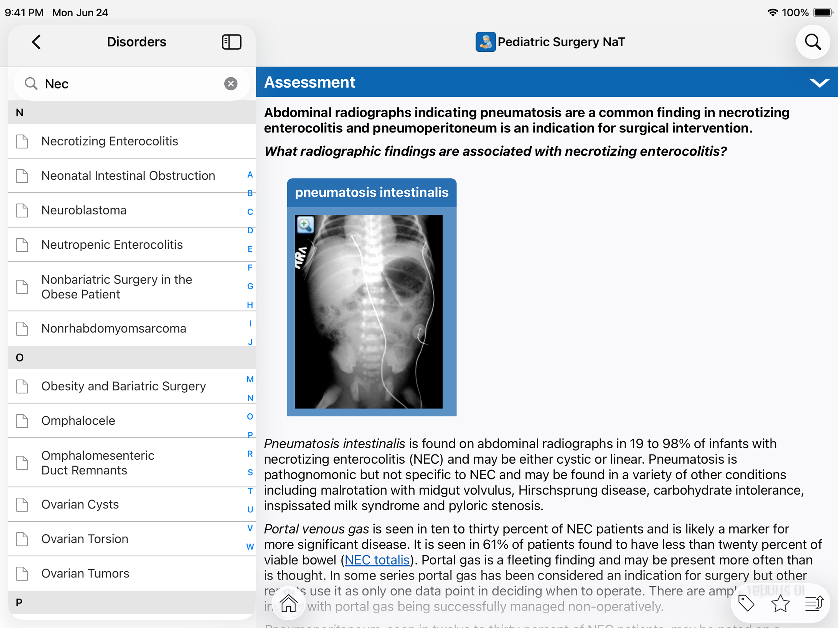 APSA Pediatric Surgery Library screenshot 9