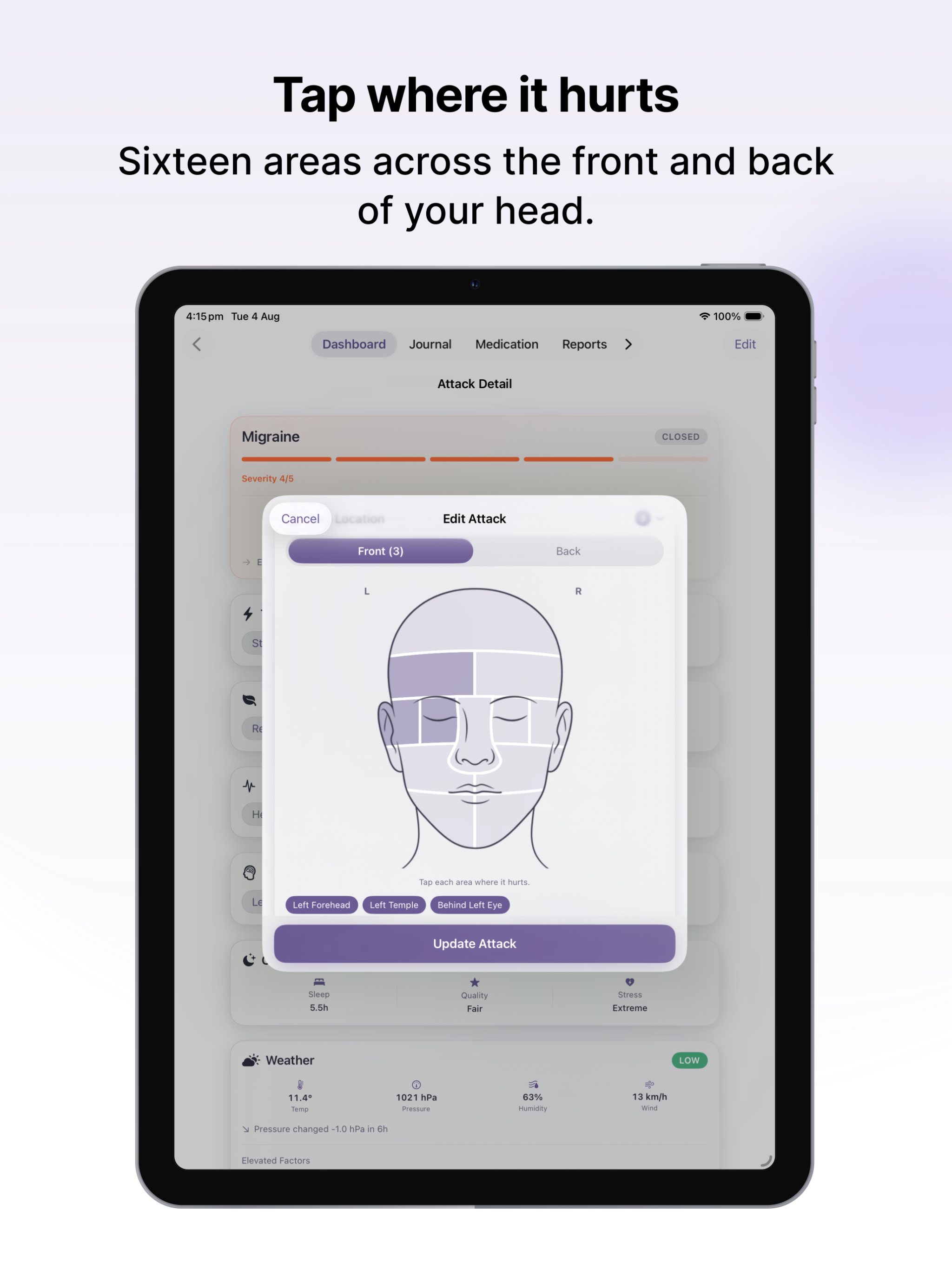 MiTracker: Migraine Tracker screenshot 12