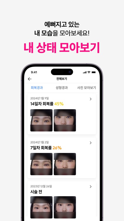 페이스핏 - 성형,견적,상담,분석,시술,얼굴,시뮬레이션 screenshot-3