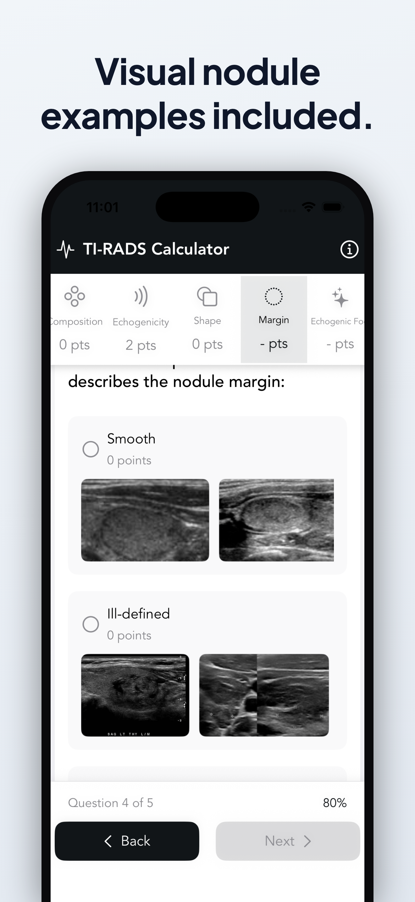 Easy TI-RADS Calculator screenshot 3