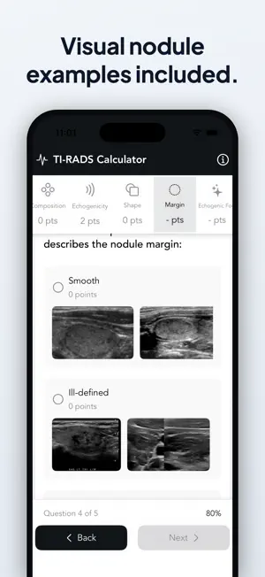 Easy TI-RADS Calculator screenshot 3
