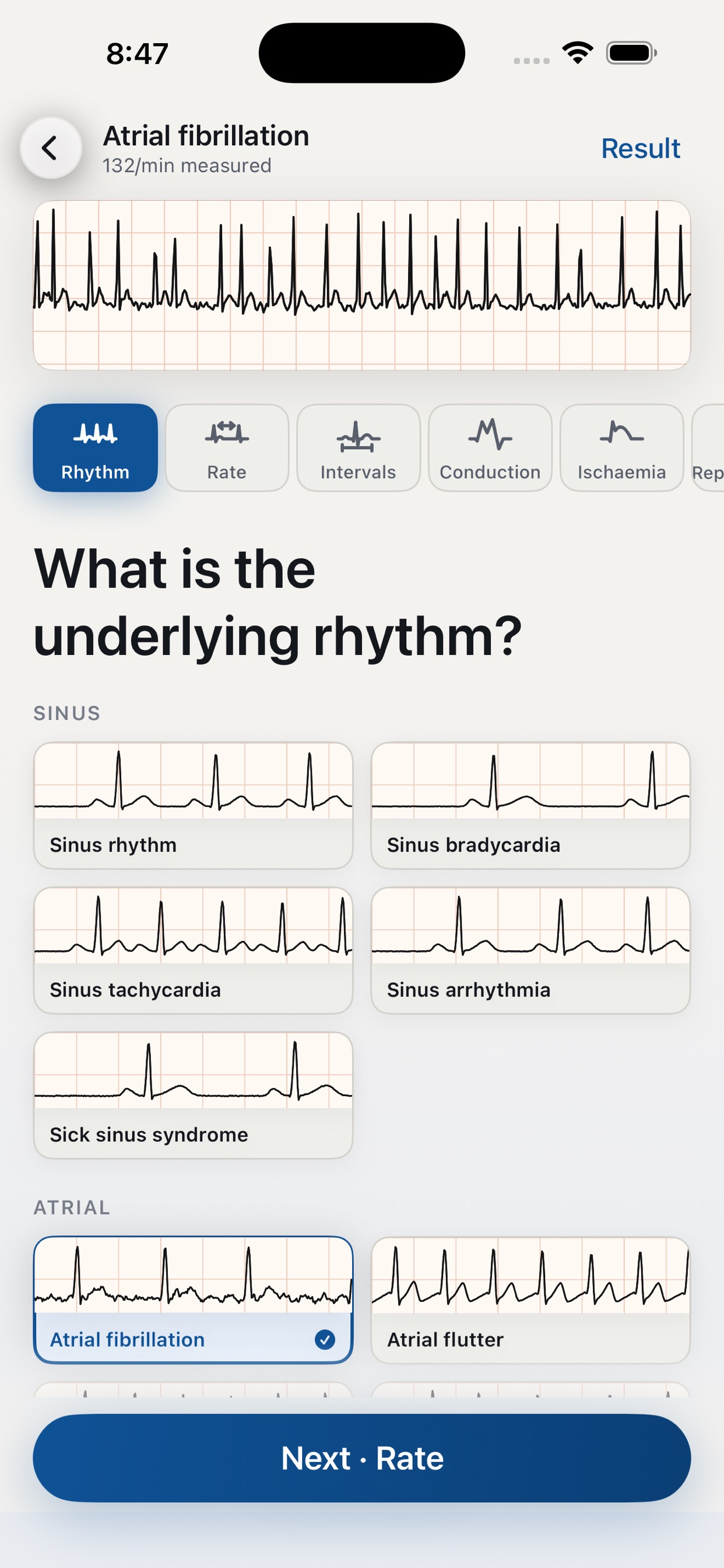 Screenshot 5 of ECG Builder