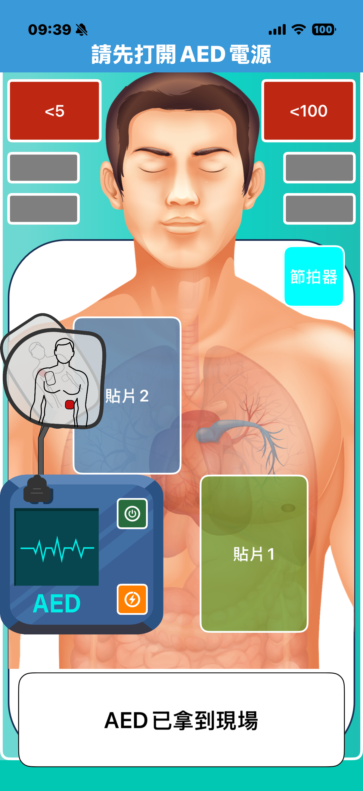 智慧阿榮