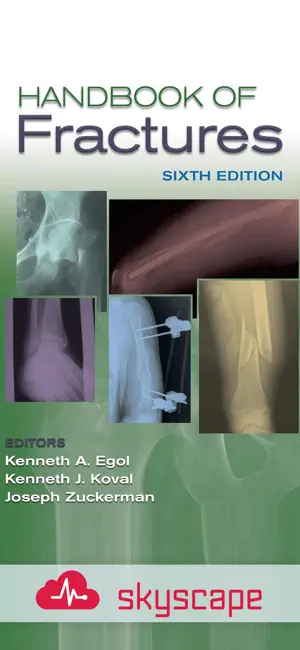 Handbook of Fractures screenshot 1