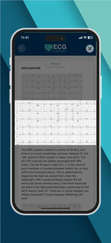 ECG Expert screenshot 4 of 4
