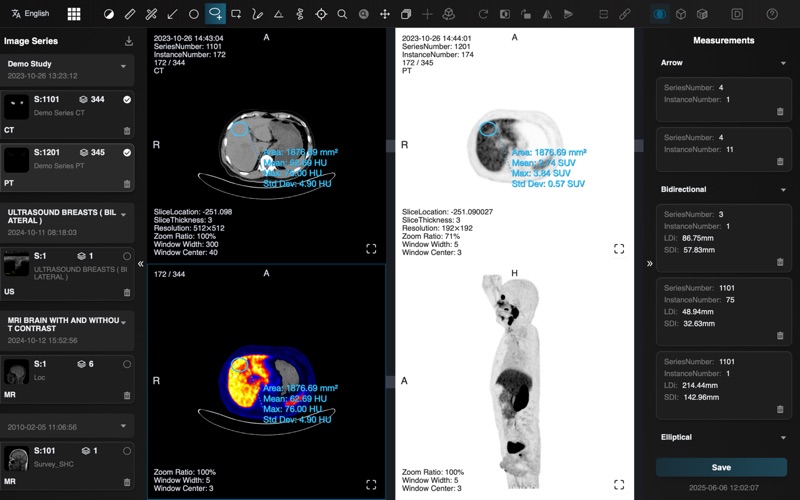 Dicom Browser Screenshot
