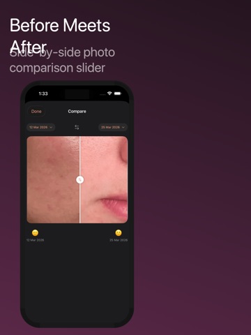 GlowLog — Skincare Tracker iPad screenshot