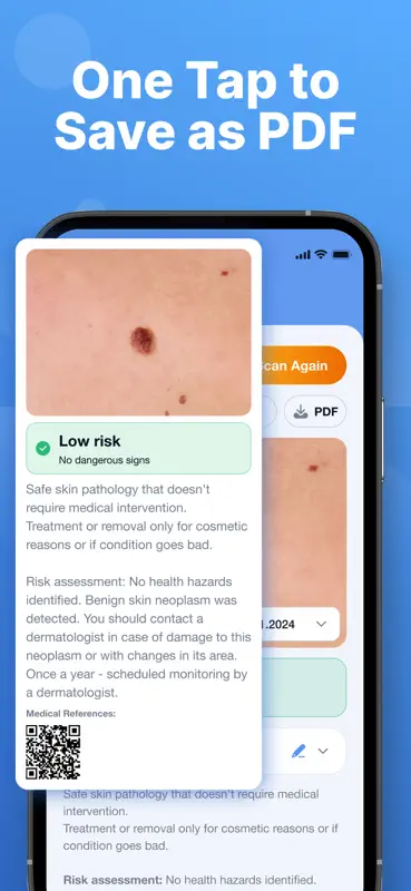 AI Skin Scanner: Mole Tracker screenshot 4 of 5