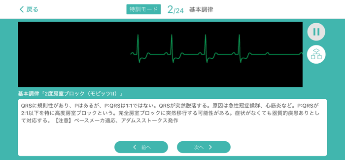 心電図マスターアプリ