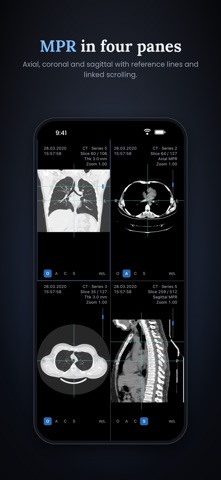 PlexusMD Viewer screenshot 2