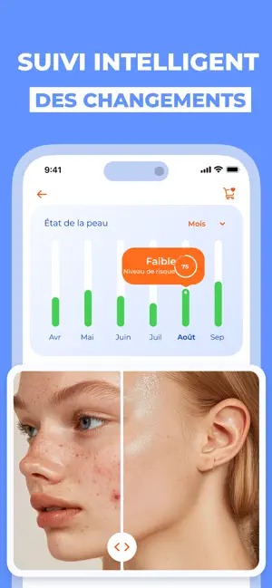 Scanner IA Santé de Peau iPhone screenshot 6