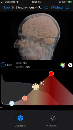 Falcon Mx - DICOM Viewer screenshot 4