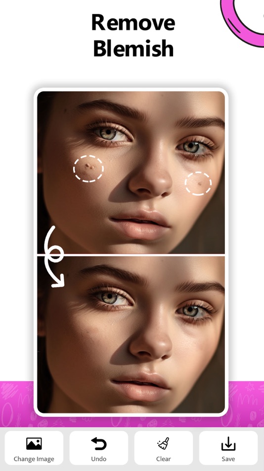 #4. Remove Object - AI Erase Photo (iOS) De: wilson sonkamble