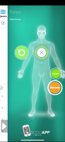 ScolioApp Screenshot 1 of 2
