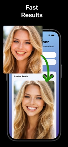 Teeth Whitener - Pearl iPhone screenshot