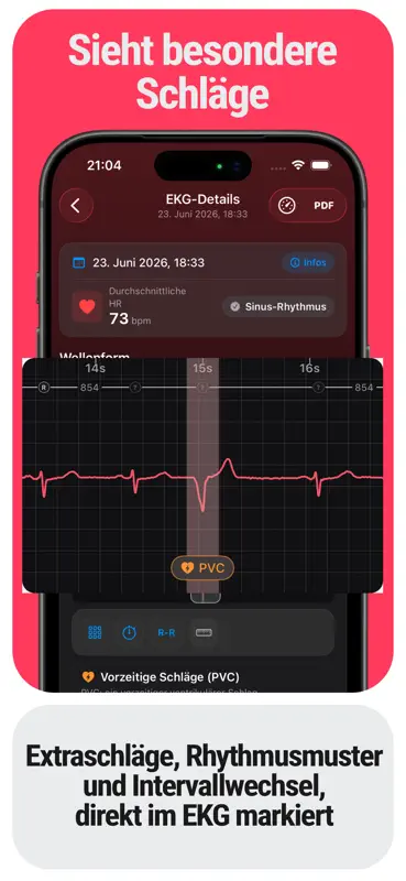 ECG Tracker+: Salud Cardíaca screenshot 2 of 6