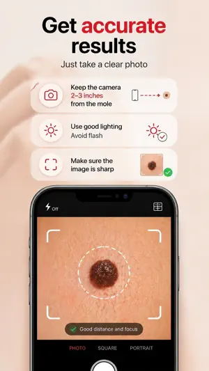 Skin Scanner AI: Mole Check screenshot 2