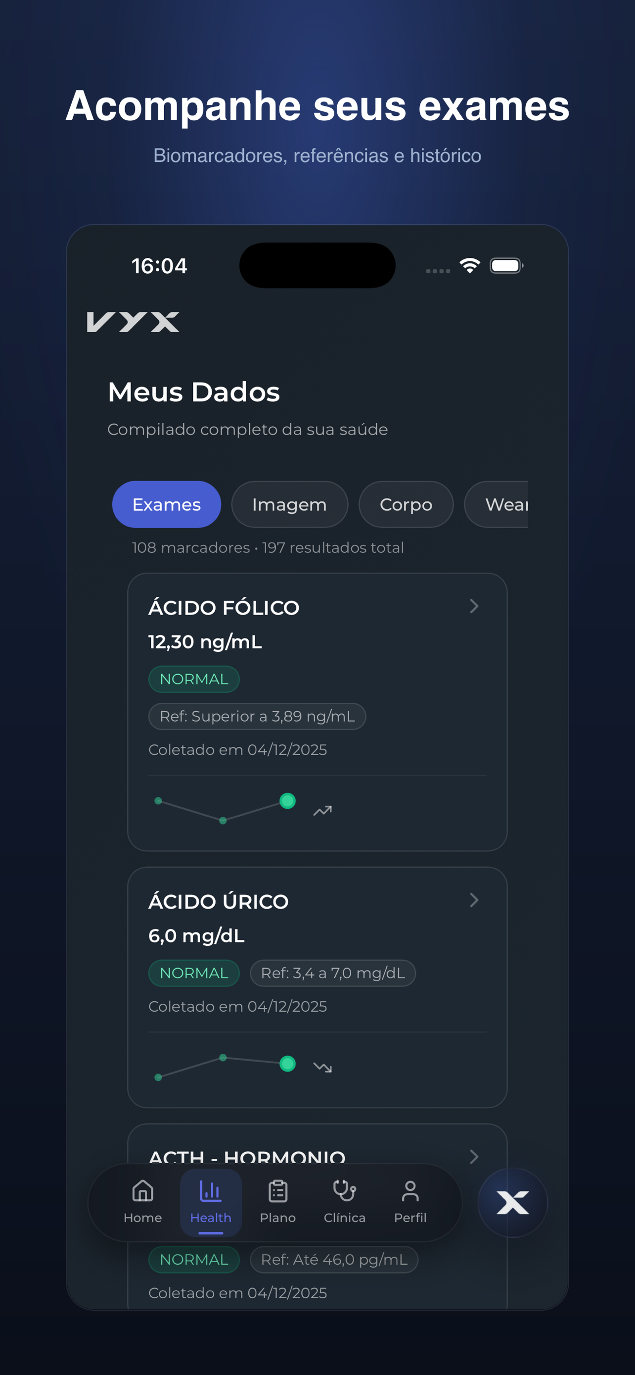 VYX screenshot 4
