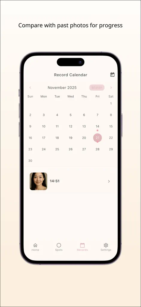 SpotTrack - Spot & Skin Tra... - Graphics & Design App | MWM