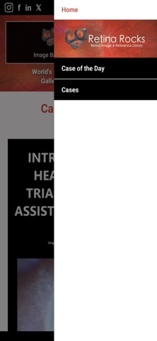 Retina Rocks screenshot