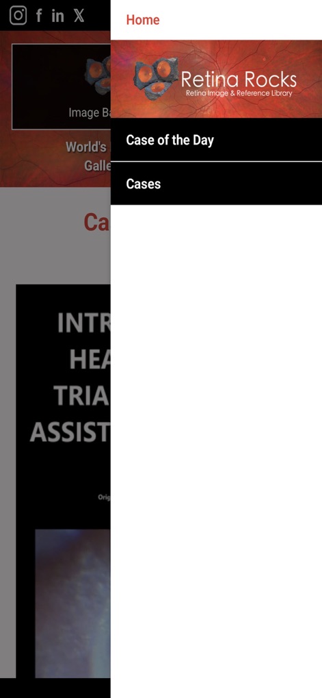 Retina Rocks - Medical App | MWM