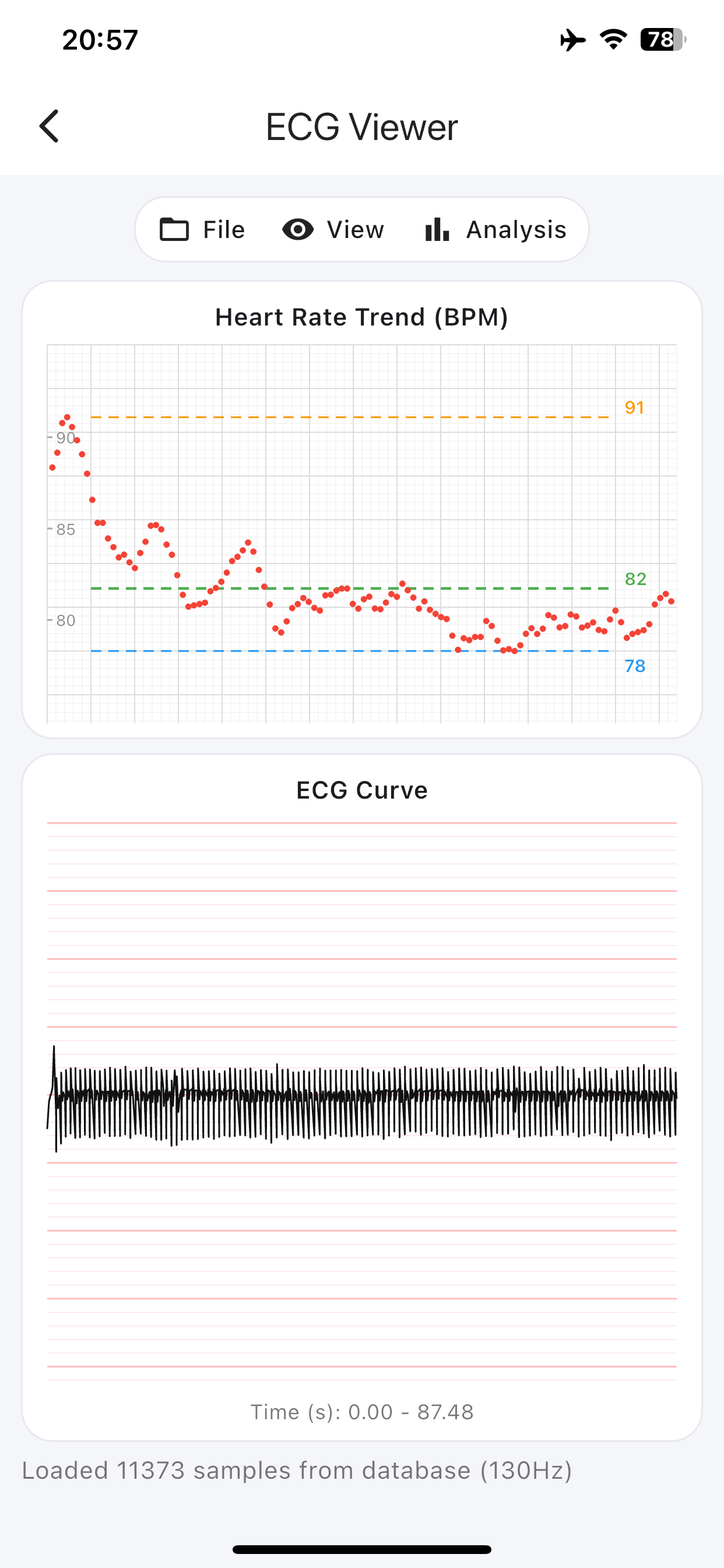 ECG Suite