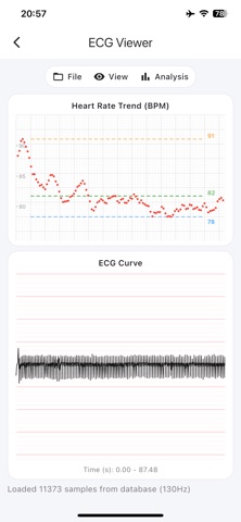 ECG Suite screenshot