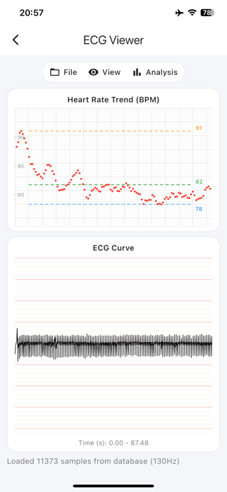 ECG Suite Screenshot 6 of 9