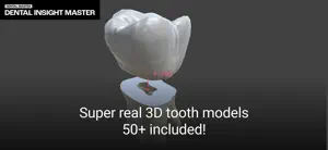 Dental InsightMaster screenshot 3