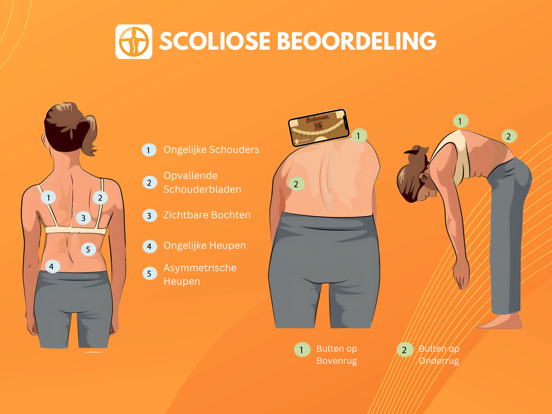 Scoliometer iPad app afbeelding 4