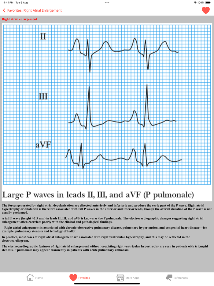 Clinical ECG Interpretation