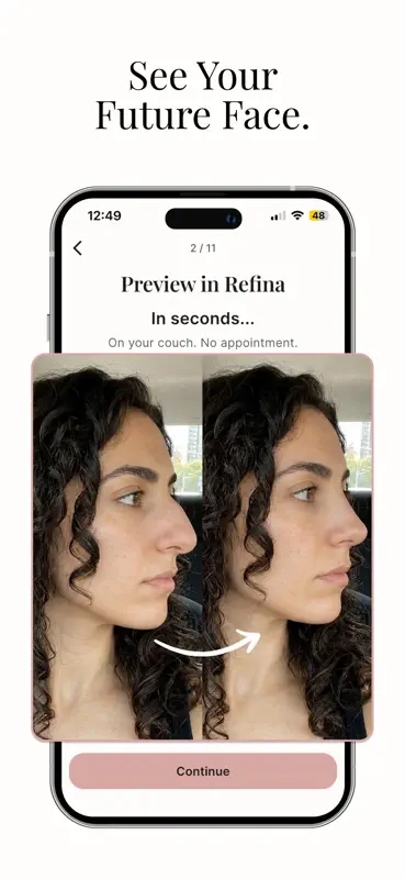 Refina: AI Plastic Surgery screenshot 1 of 6