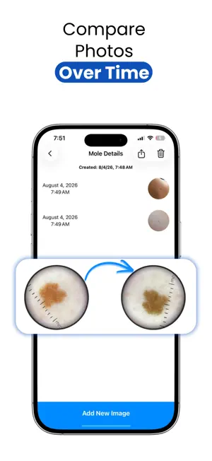 Jeskin Mole Tracker screenshot 4
