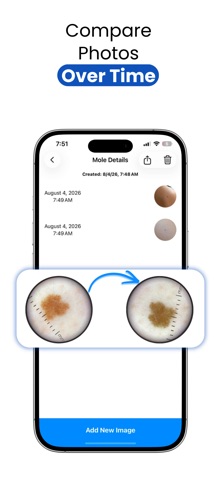 Jeskin Mole Tracker Screenshot 4 of 5