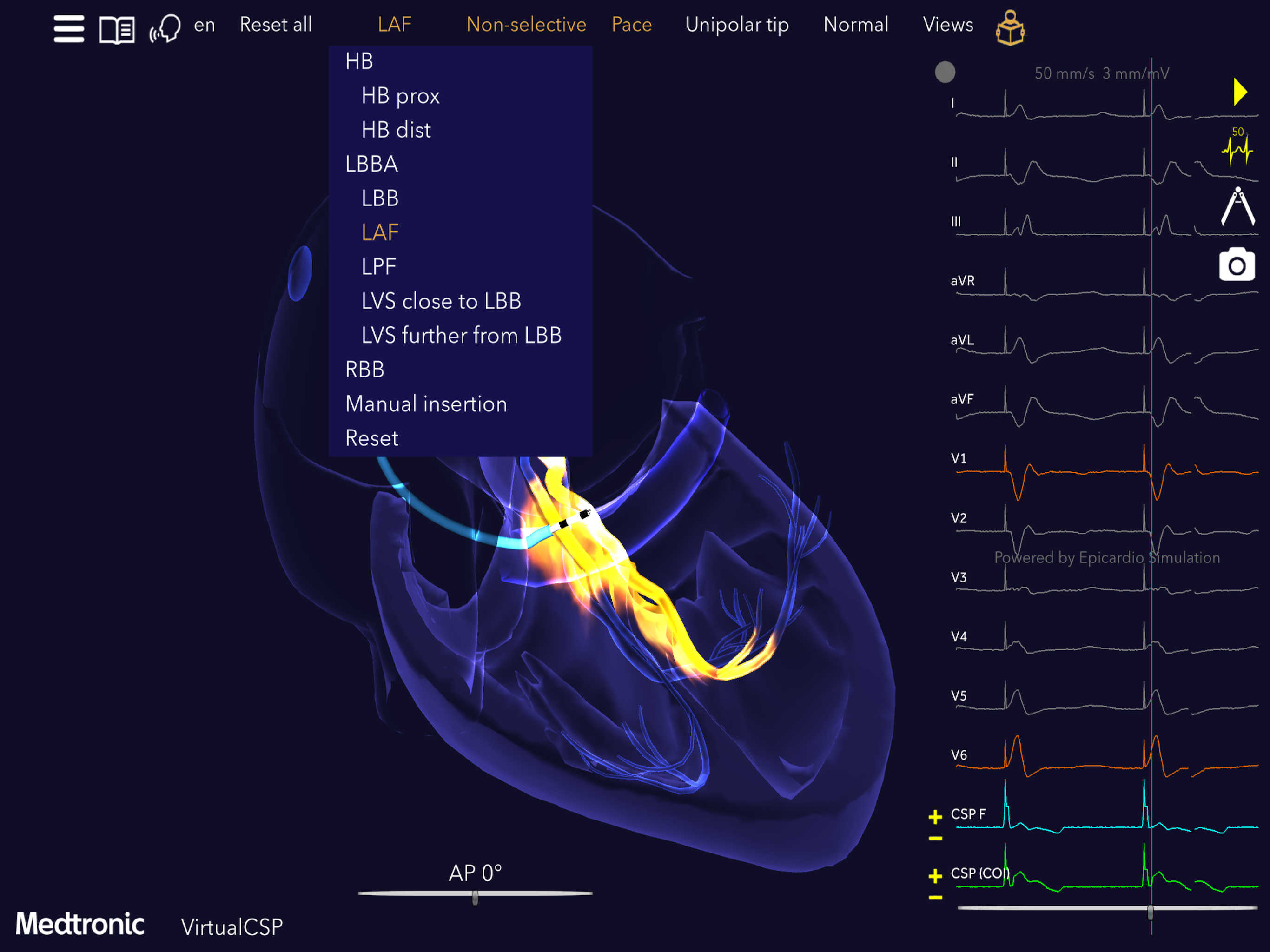 Medtronic VirtualPulse screenshot 16