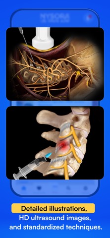 US Pain Blocksのおすすめ画像4