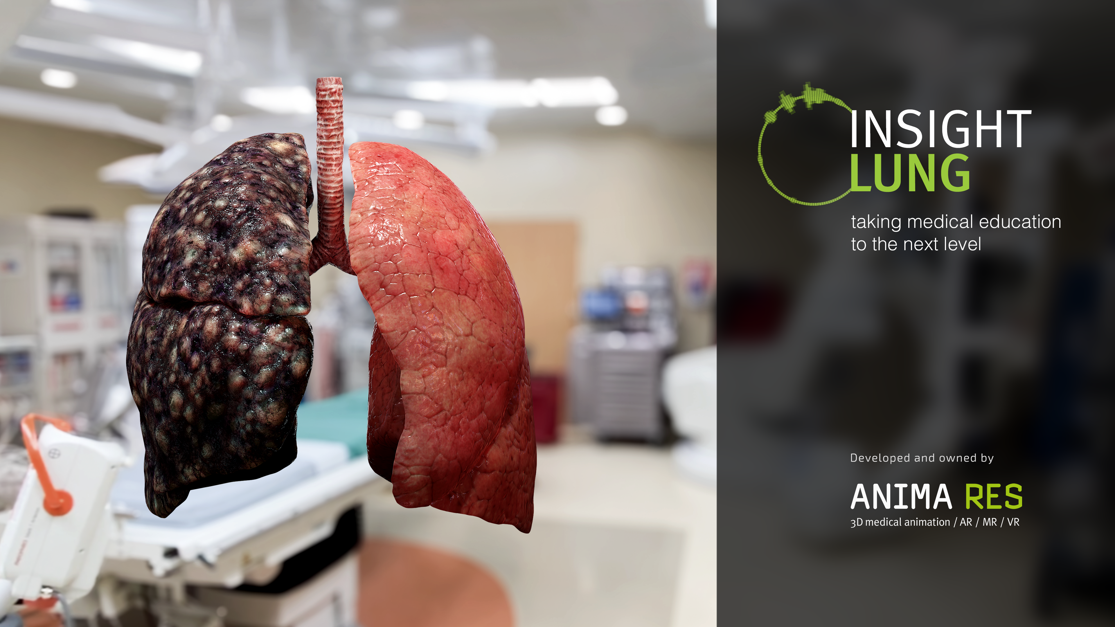 INSIGHT LUNG screenshot 21