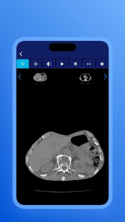 Nexus Telerradiologia screenshot-3