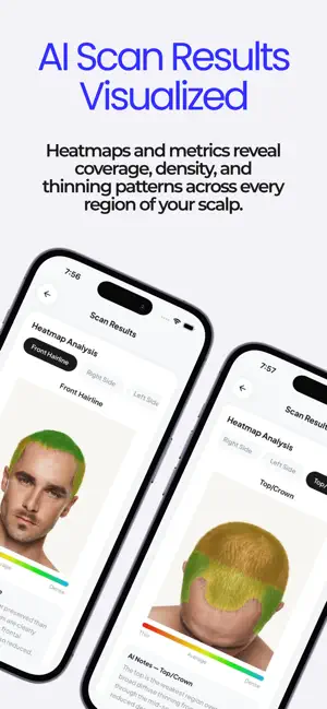 Folicx: Hair Health Tracking screenshot 3