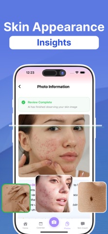 SkinAI Scan - Mole Tracker Screenshot 1 of 8