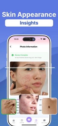 SkinAI Scan - Mole Tracker screenshot 1