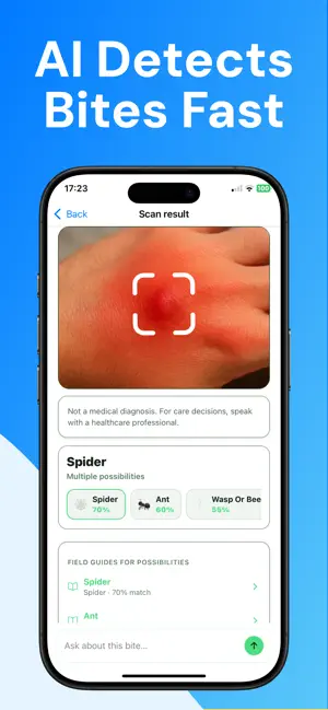 Bug Bite Identifier: BiteSight screenshot 4