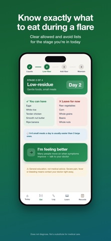 Diverticulitis: Diet & Flare Screenshot 1 of 7