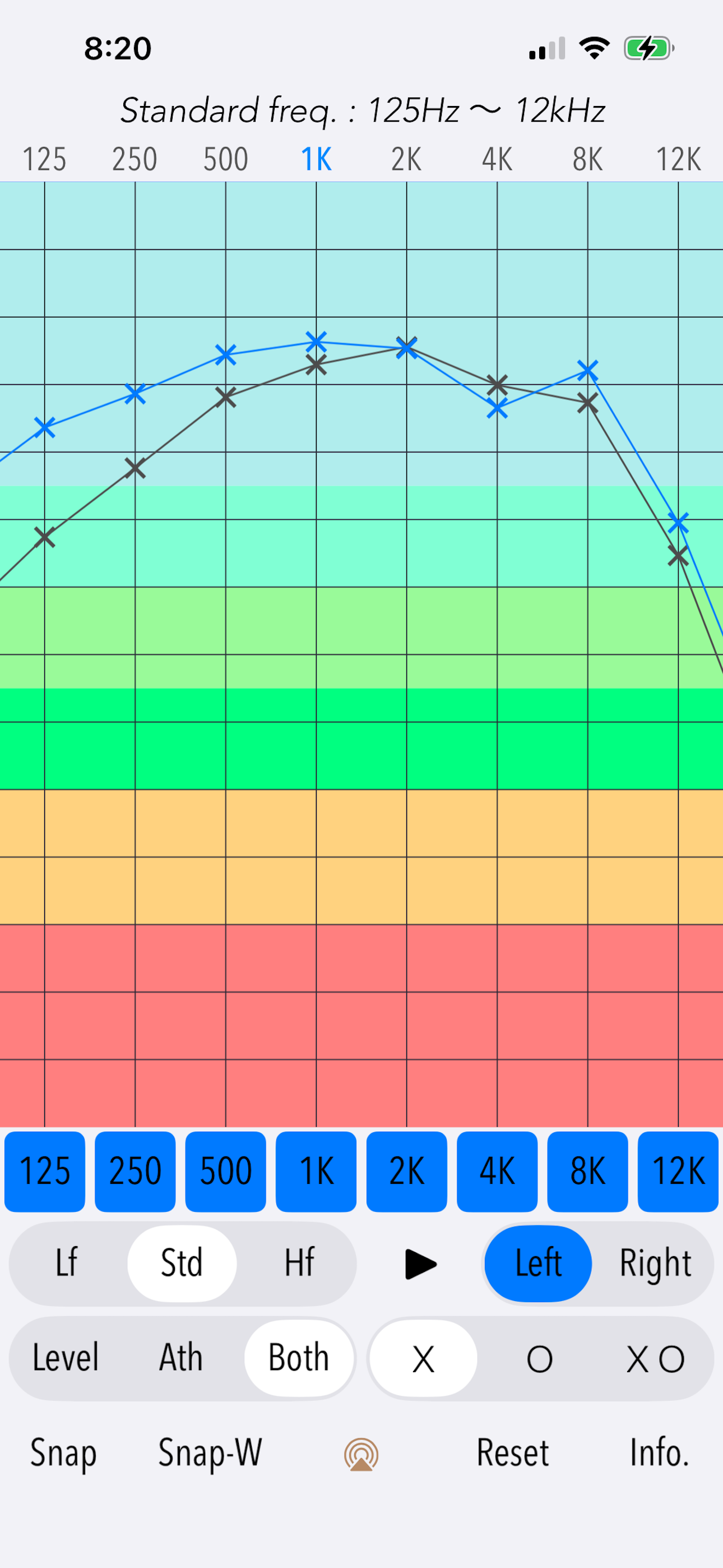 Hearing Analyzer Portrait