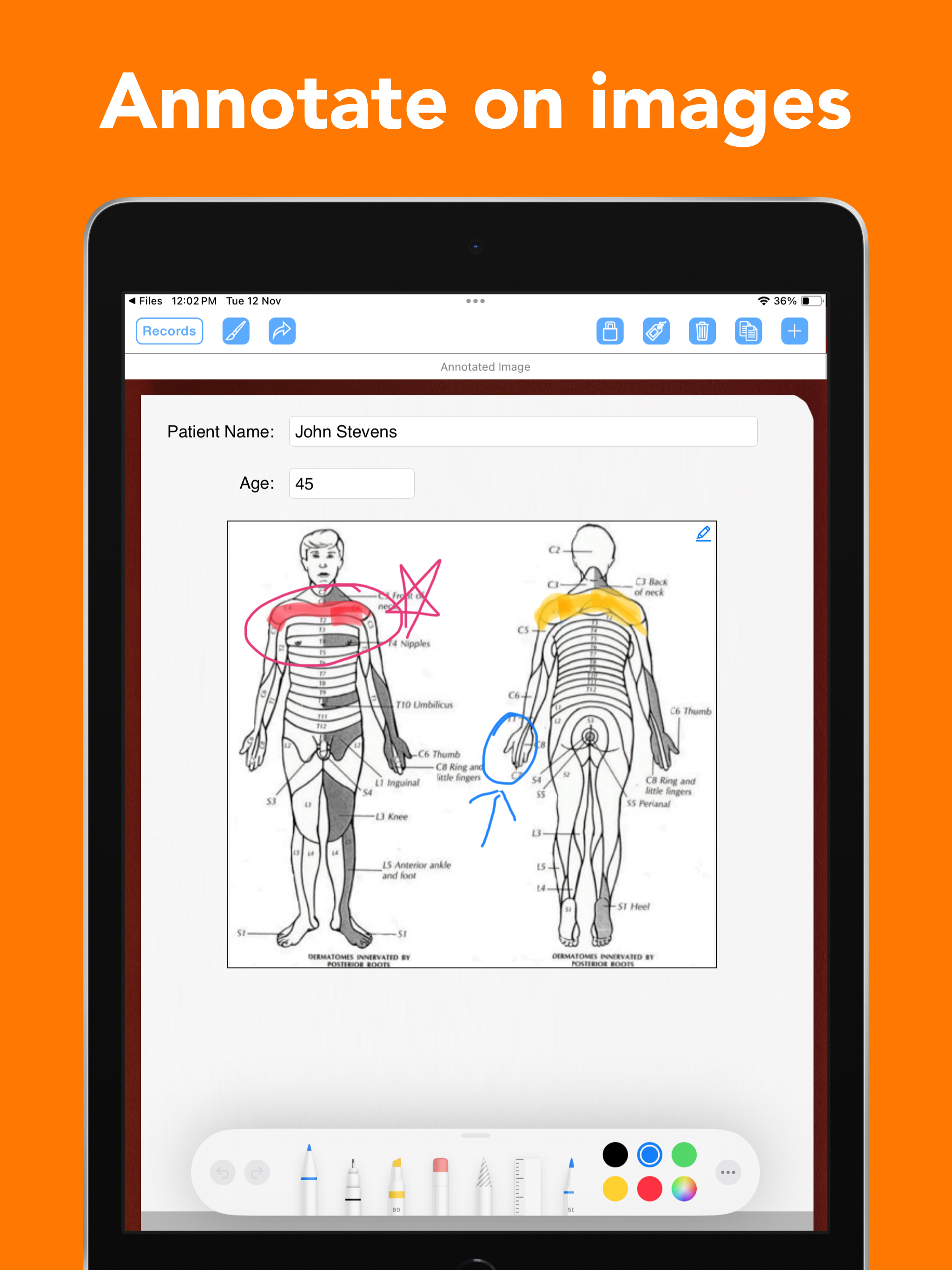 FormConnect ProMax